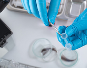Drugsscreening: technieken, mogelijkheden en kanttekeningen