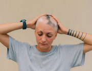 Alopecia bij gebruik van bupropion 