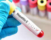 Hepatitis C-virusbehandeling met direct-werkende antivirale middelen in de verslavingszorg