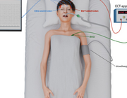 Behandeling van een superrefractaire status epilepticus